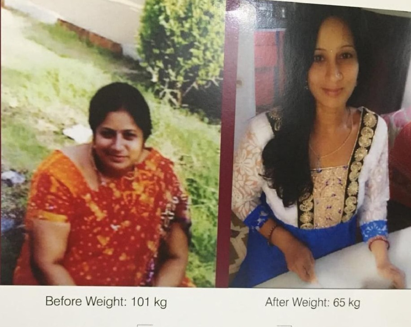 Weight Loss Treatment